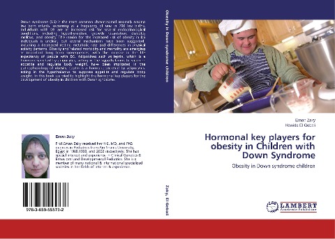 Hormonal key players for obesity in Children with Down Syndrome: Obesity in Down syndrome children