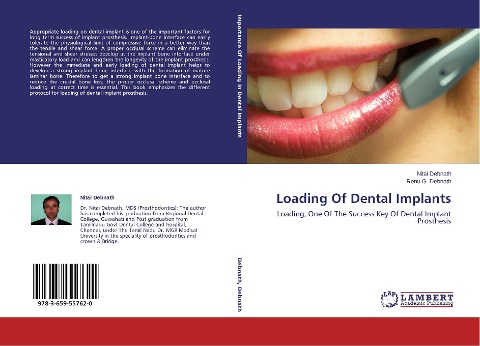 Loading Of Dental Implants: Loading, One Of The Success Key Of Dental Implant Prosthesis