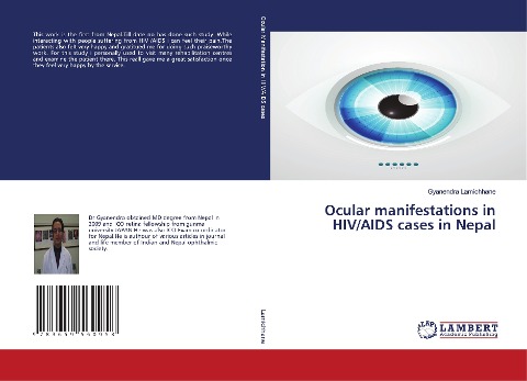 Ocular manifestations in HIV/AIDS cases in Nepal