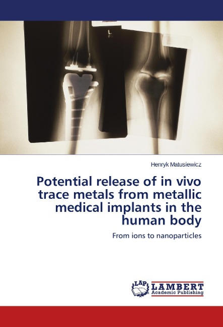 Potential release of in vivo trace metals from metallic medical implants in the human body: From ions to nanoparticles
