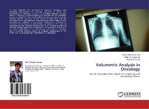 Volumetric Analysis in Oncology: Use of computerized analysis for screening and evaluating tumors