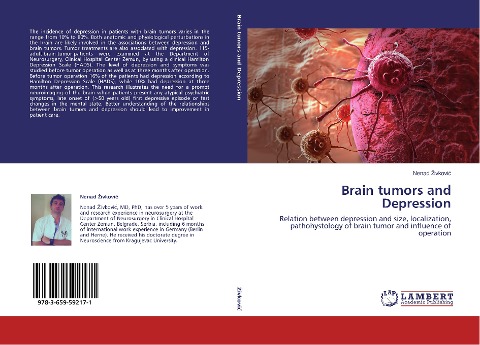Brain tumors and Depression: Relation between depression and size, localization, pathohystology of brain tumor and influence of operation