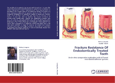 Fracture Resistance Of Endodontically Treated Teeth: An in vitro comparative evaluation with different resin based adhesive systems