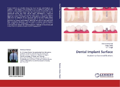 Dental Implant Surface: Implant surface modifications