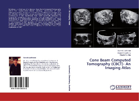 Cone Beam Computed Tomography (CBCT)- An Imaging Atlas