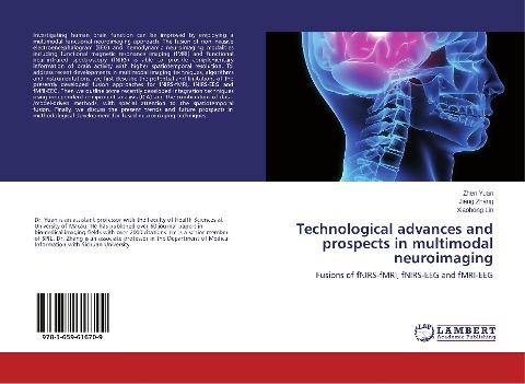 Technological advances and prospects in multimodal neuroimaging: Fusions of fNIRS-fMRI, fNIRS-EEG and fMRI-EEG