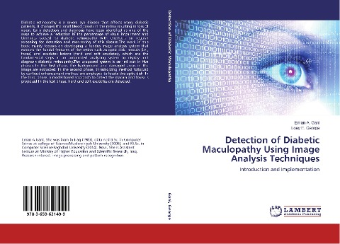 Detection of Diabetic Maculopathy Using Image Analysis Techniques: Introduction and Implementation