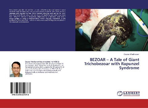 BEZOAR - A Tale of Giant Trichobezoar with Rapunzel Syndrome