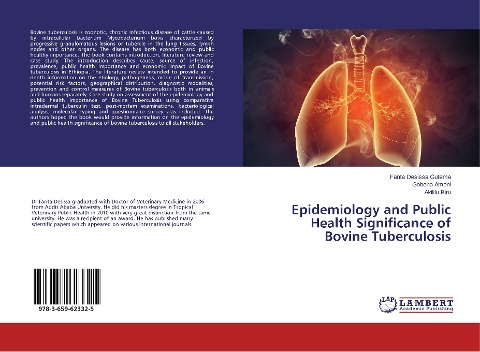 Epidemiology and Public Health Significance of Bovine Tuberculosis