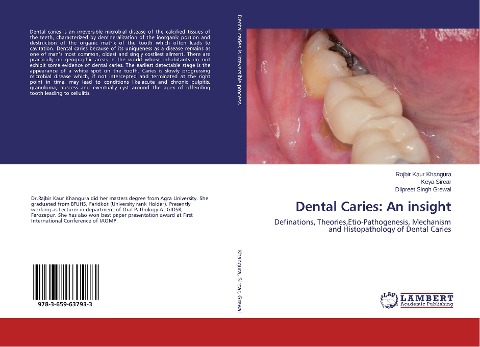 Dental Caries: An insight: Definations, Theories,Etio-Pathogenesis, Mechanism and Histopathology of Dental Caries