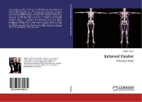 External Fixator: A Practical Guide