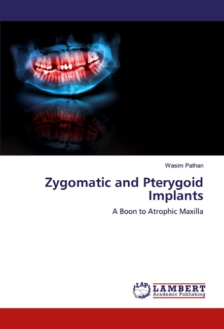 Zygomatic and Pterygoid Implants: A Boon to Atrophic Maxilla