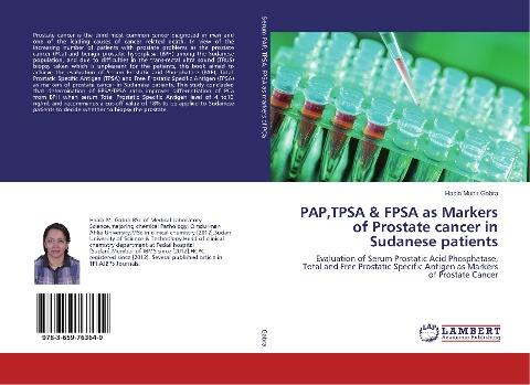 PAP,TPSA & FPSA as Markers of Prostate cancer in Sudanese patients: Evaluation of Serum Prostatic Acid Phosphatase, Total and Free Prostatic Specific Antigen as Markers of Prostate Cancer