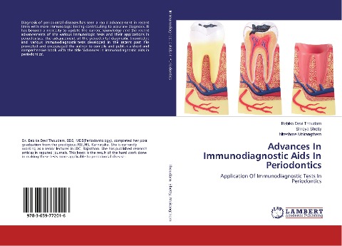 Advances In Immunodiagnostic Aids In Periodontics: Application Of Immunodiagnostic Tests In Periodontics