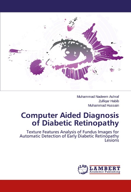 Computer Aided Diagnosis of Diabetic Retinopathy: Texture Features Analysis of Fundus Images for Automatic Detection of Early Diabetic Retinopathy Lesions