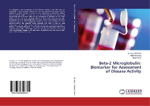 Beta-2 Microglobulin: Biomarker for Assessment of Disease Activity