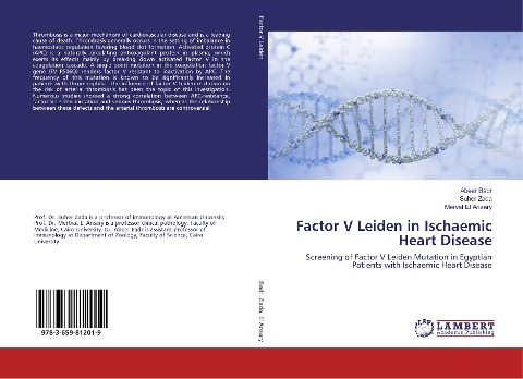 Factor V Leiden in Ischaemic Heart Disease: Screening of Factor V Leiden Mutation in Egyptian Patients with Ischaemic Heart Disease