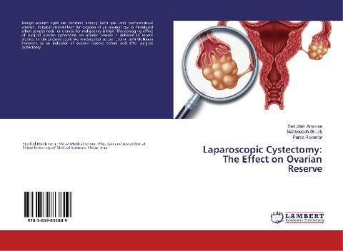 Laparoscopic Cystectomy: The Effect on Ovarian Reserve