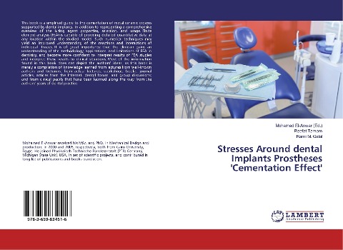 Stresses Around dental Implants Prostheses Cementation Effect