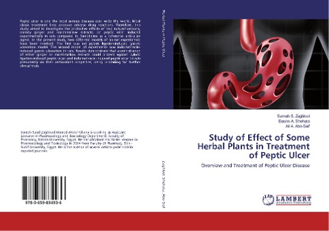 Study of Effect of Some Herbal Plants in Treatment of Peptic Ulcer: Overview and Treatment of Peptic Ulcer Disease