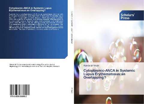 Cytoplasmic-ANCA in Systemic Lupus Erythematosus:an Overlapping?