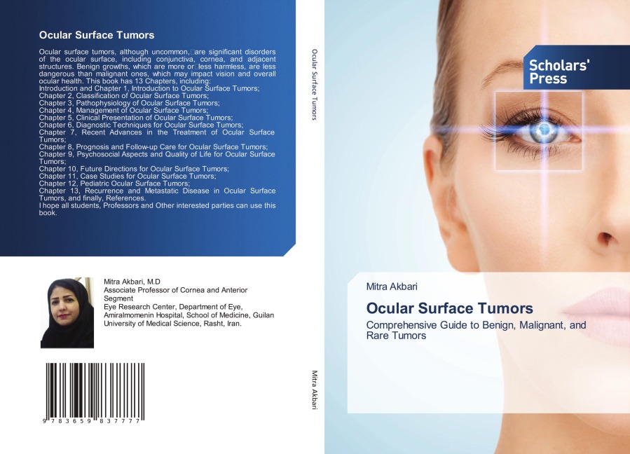 Ocular Surface Tumors: Comprehensive Guide to Benign, Malignant, and Rare Tumors