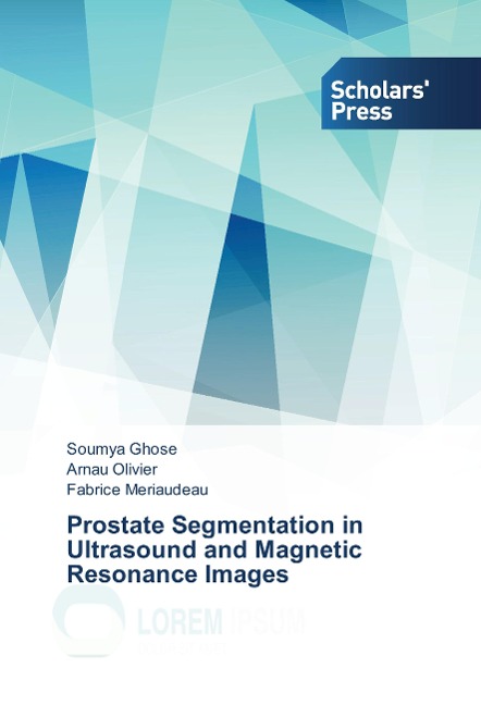 Prostate Segmentation in Ultrasound and Magnetic Resonance Images