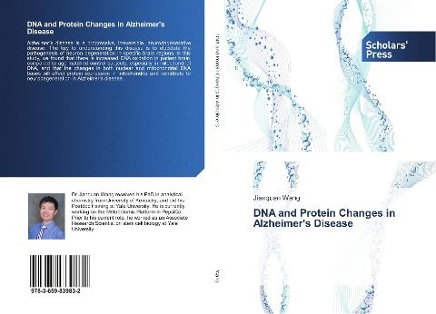 DNA and Protein Changes in Alzheimers Disease