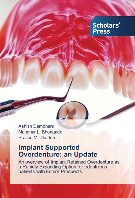 Implant Supported Overdenture: an Update: An overview of Implant Retained Overdenture as a Rapidly Expanding Option for edentulous patients with Future Prospects