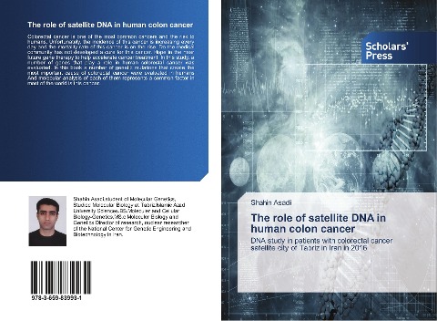 The role of satellite DNA in human colon cancer: DNA study in patients with colorectal cancer satellite city of Tabriz in Iran in 2016
