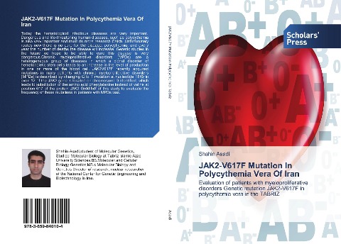 JAK2-V617F Mutation In Polycythemia Vera Of Iran: Evaluation of patients with myeloproliferative disorders Genetic mutation JAK2-V617F in polycythemia vera in the TABRIZ