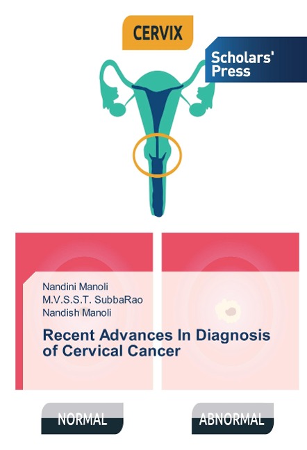 Recent Advances In Diagnosis of Cervical Cancer