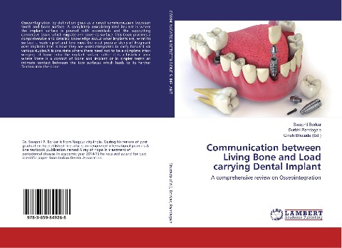 Communication between Living Bone and Load carrying Dental Implant: A comprehensive review on Osseointegration