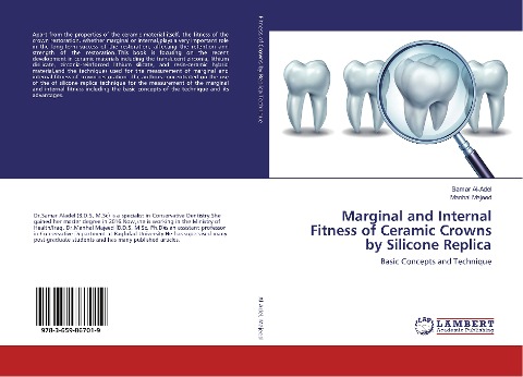 Marginal and Internal Fitness of Ceramic Crowns by Silicone Replica: Basic Concepts and Technique