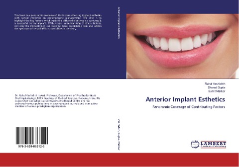 Anterior Implant Esthetics: Panoramic Coverage of Contributing Factors