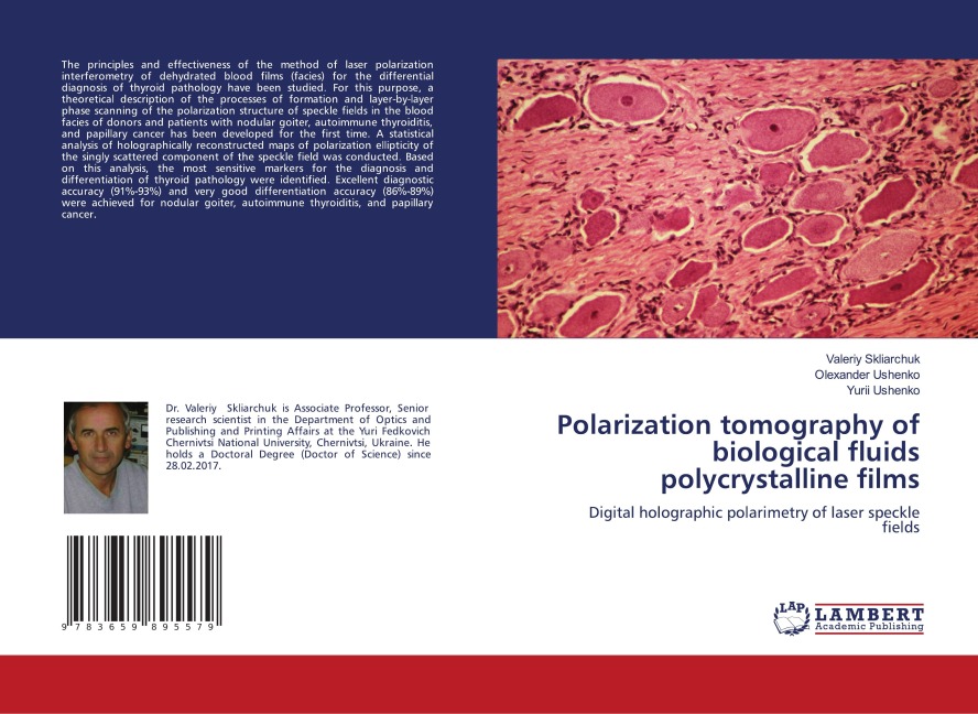 Polarization tomography of biological fluids polycrystalline films: Digital holographic polarimetry of laser speckle fields