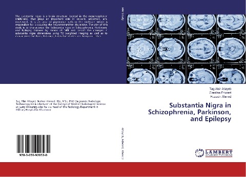 Substantia Nigra in Schizophrenia, Parkinson, and Epilepsy