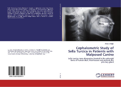 Cephalometric Study of Sella Turcica in Patients with Malposed Canine: Sella turcica-bony depression located in the sphenoid bone of human skull, that houses and protects the pituitary gland
