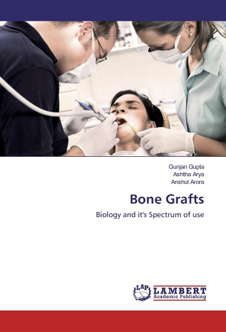 Bone Grafts: Biology and its Spectrum of use