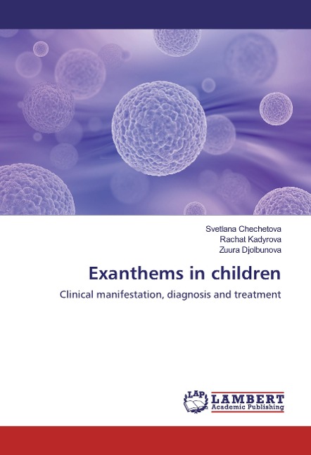Exanthems in children: Clinical manifestation, diagnosis and treatment