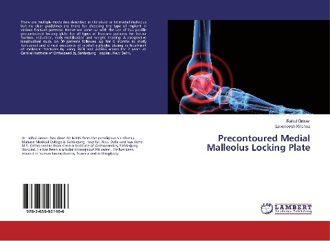Precontoured Medial Malleolus Locking Plate