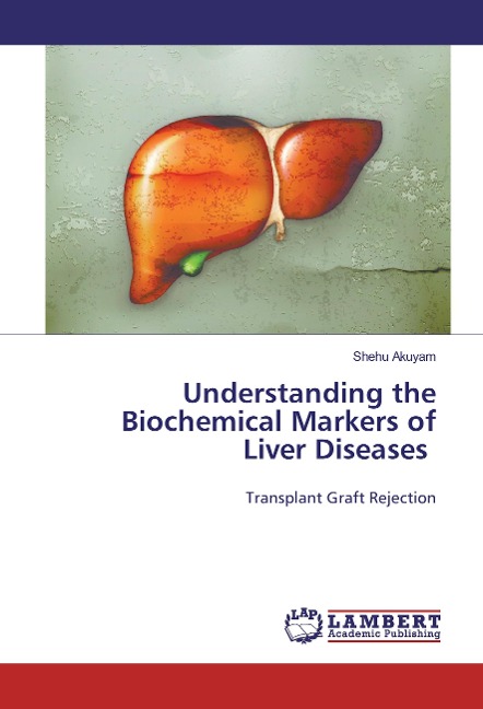 Understanding the Biochemical Markers of Liver Diseases: Transplant Graft Rejection
