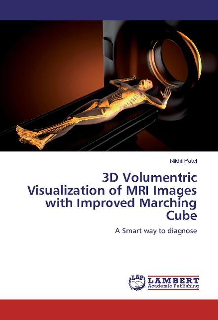 3D Volumentric Visualization of MRI Images with Improved Marching Cube: A Smart way to diagnose