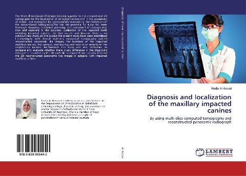 Diagnosis and localization of the maxillary impacted canines: By using multi-slice computed tomography and reconstructed panoramic radiograph