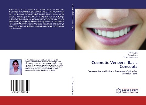 Cosmetic Veneers: Basic Concepts: Conservative and Esthetic Treatment Option For Anterior Teeth