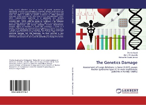 The Genetics Damage: Assessment of Large deletions in Gene VLGR1 causes Ascher syndrome type IIC in male and female patients in Family TABRIZ