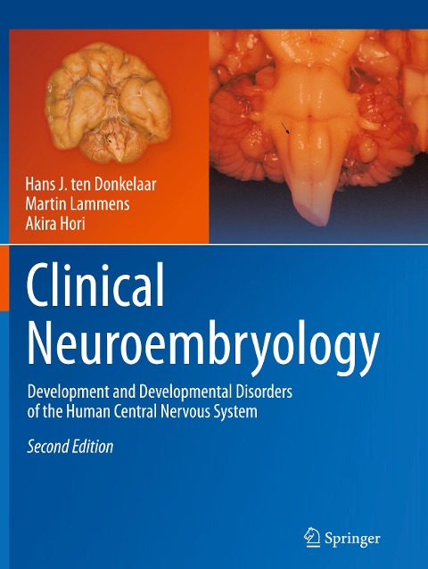 Clinical Neuroembryology: Development and Developmental Disorders of the Human Central Nervous System