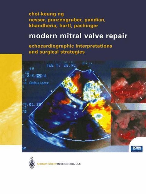 Modern Mitral Valve Repair: Echocardiographic Interpretations and Surgical Strategies