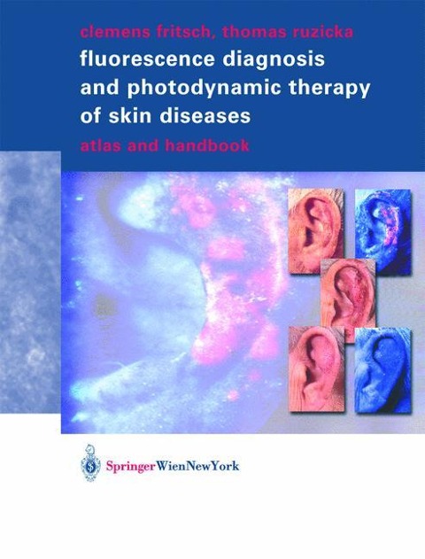 Fluorescence Diagnosis and Photodynamic Therapy of Skin Diseases: Atlas and Handbook