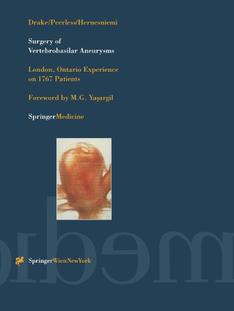 Surgery of Vertebrobasilar Aneurysms: London, Ontario Experience on 1767 Patients